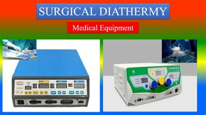How much does diathermy cost?