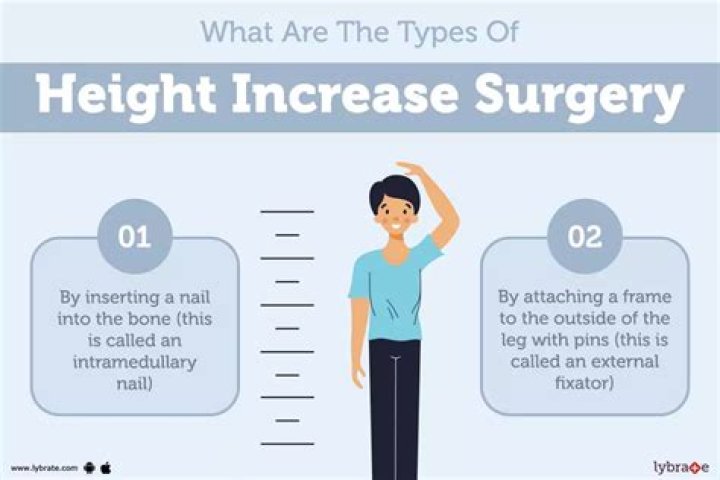 How much does height increase surgery cost?
