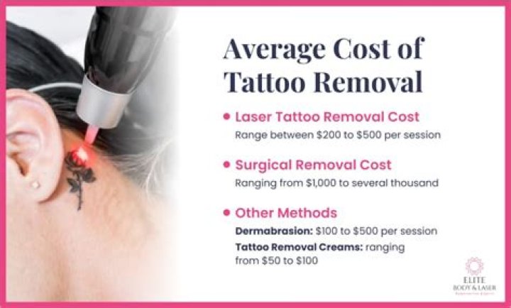 How much does tattoo removal cost per hour?