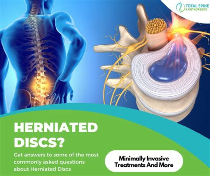 How much is a herniated disc worth in a workers comp?