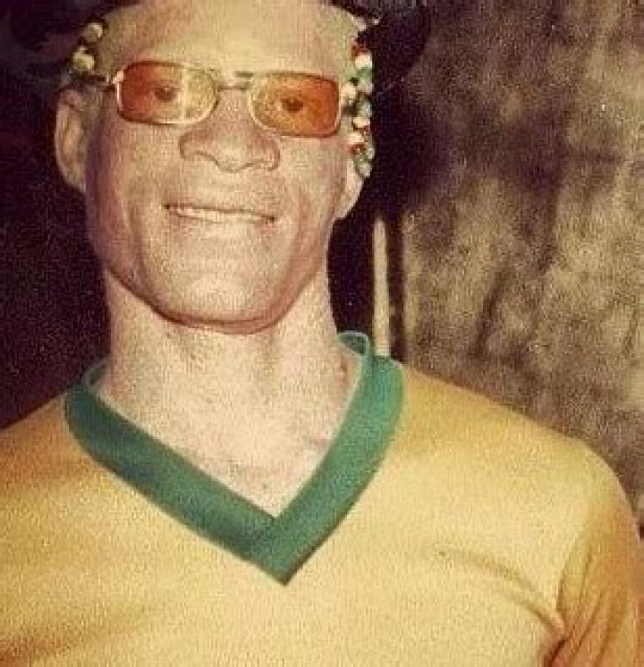 How old is Jamaican artist Yellowman?