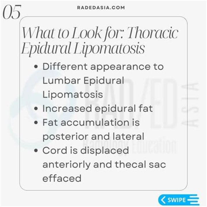 Is epidural lipomatosis rare?