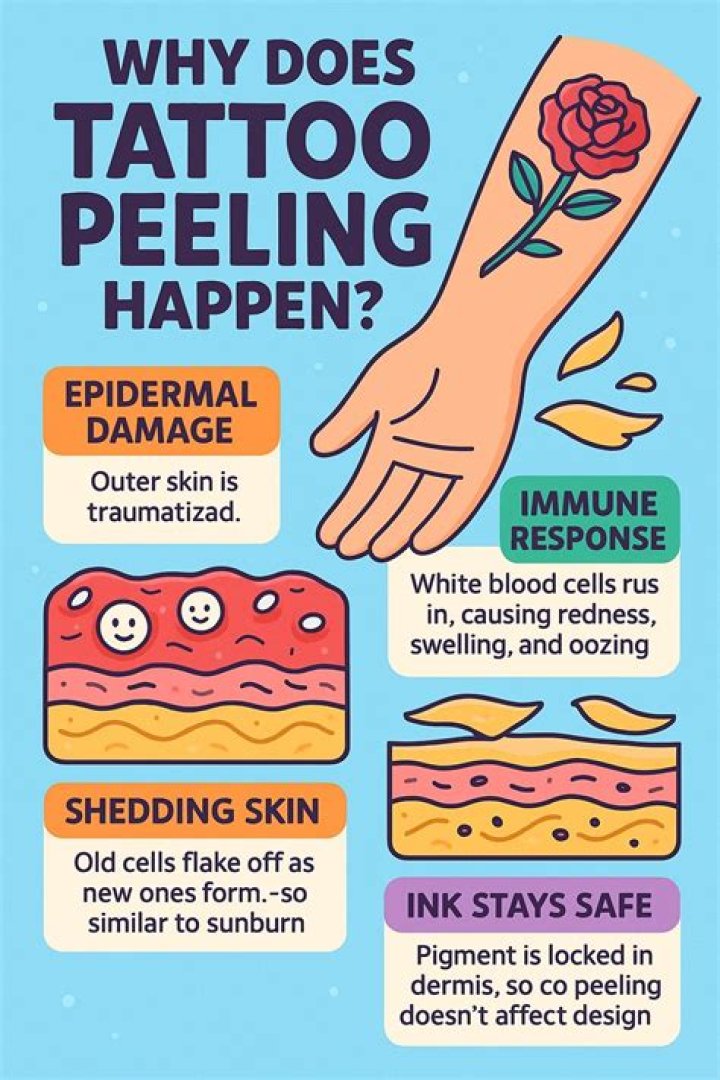 Is it peeling or pealing?