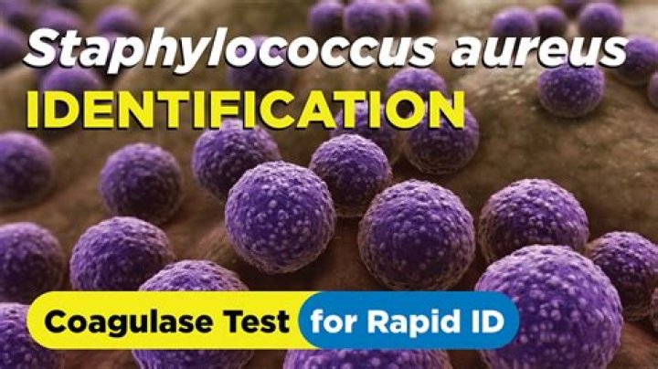 Is Staphylococcus aureus a method?