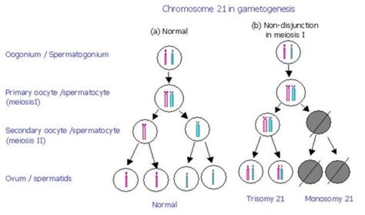 Is Trisomy 21 caused by nondisjunction?