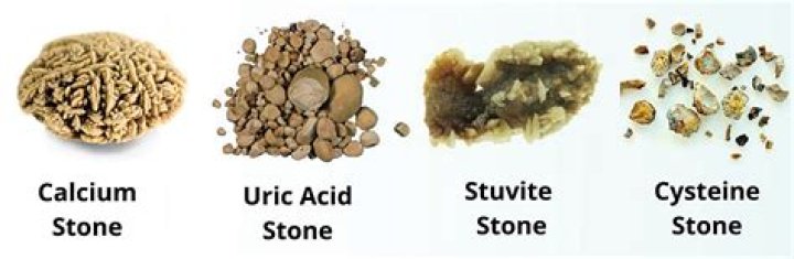 What are litho stones made of?