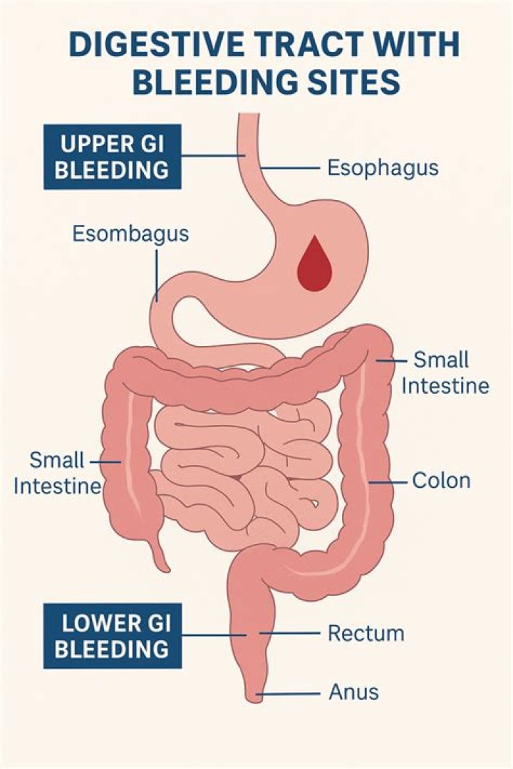 What are signs of GI bleeding?