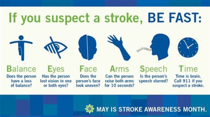 What are the 4 signs of an impending stroke?