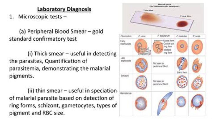 What are the diagnostic tests for malaria?