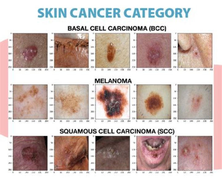 What are the first signs of skin cancer on the face?