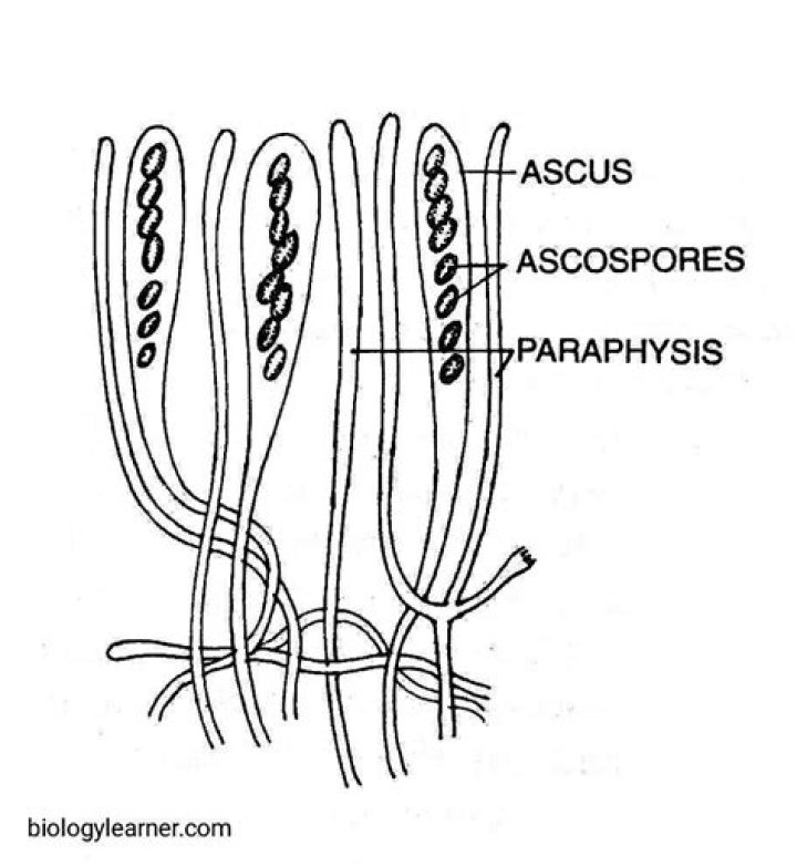 What are the main causes of ASCUS?