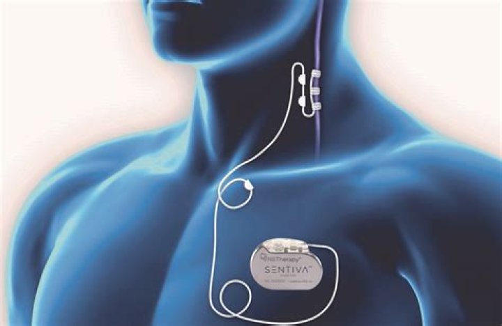 What are the side effects of a nerve stimulator?