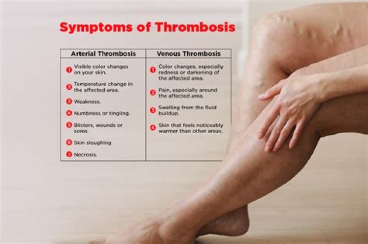 What are the signs and symptoms of thrombosis?