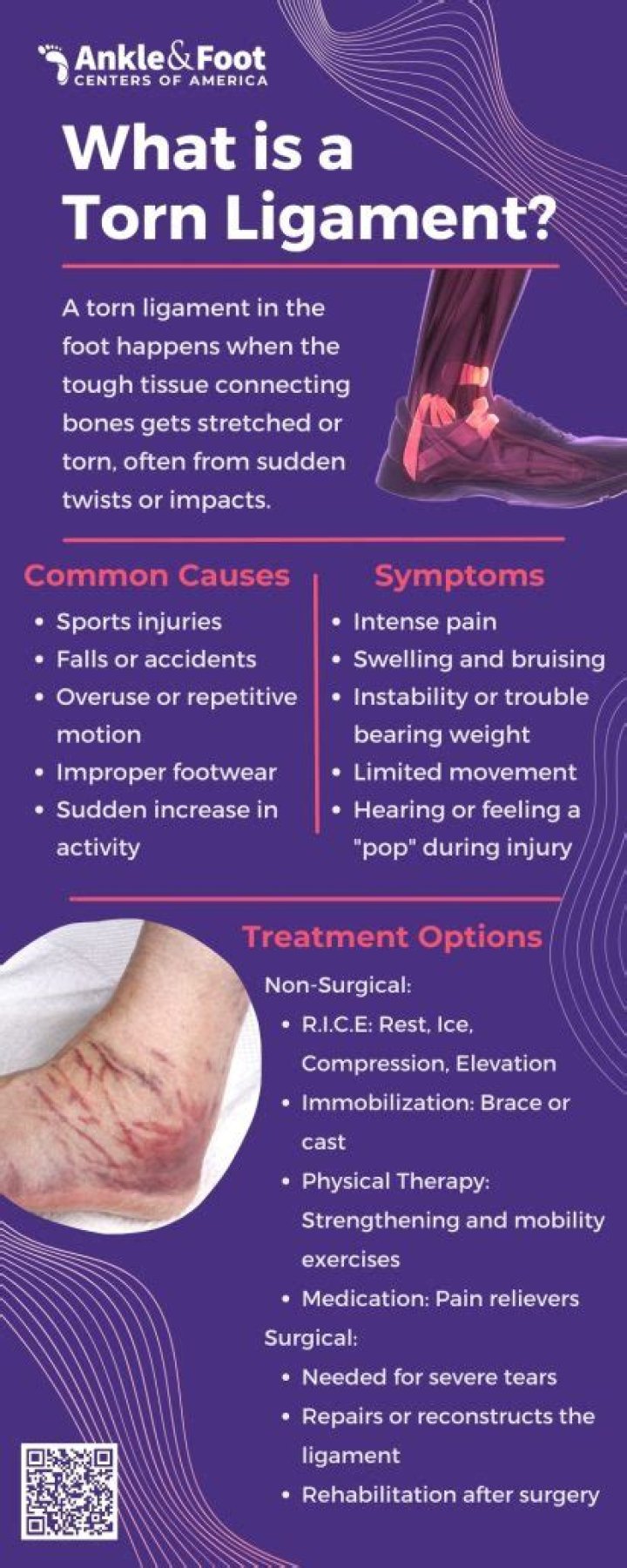 What are the symptoms of a torn ligament in the arm?