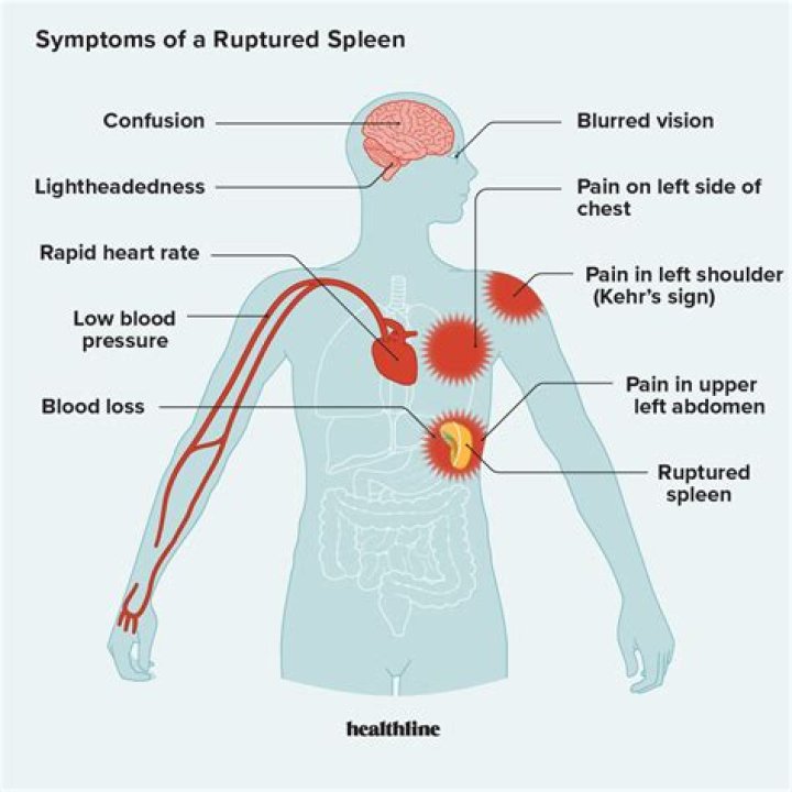 What are the symptoms of envenomation?