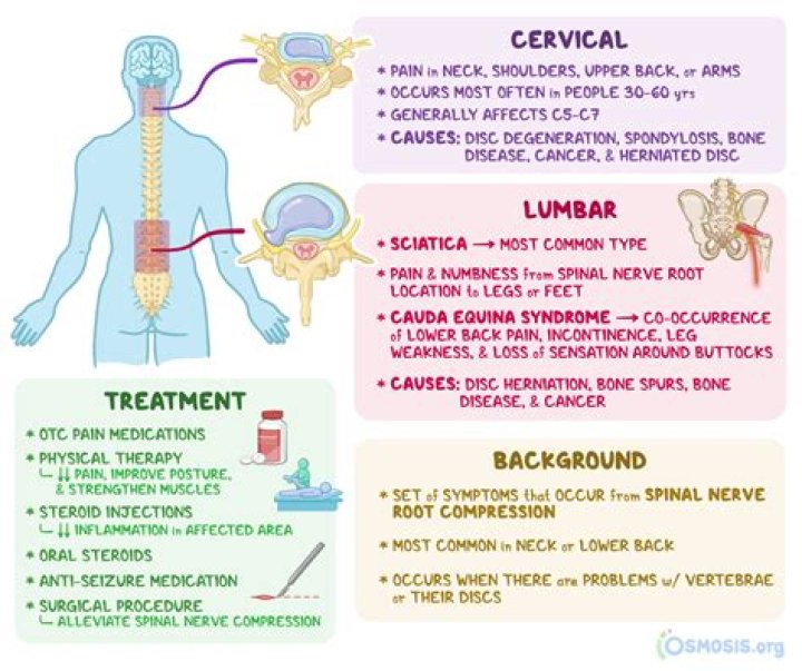 What are the symptoms of lumbosacral radiculopathy?