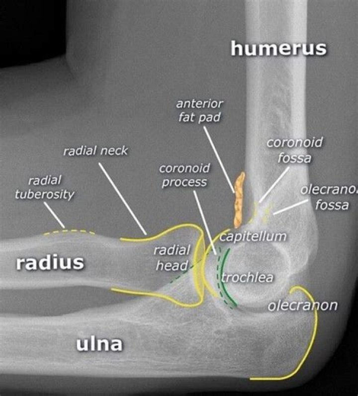 What are the three common radiographic views of the elbow?