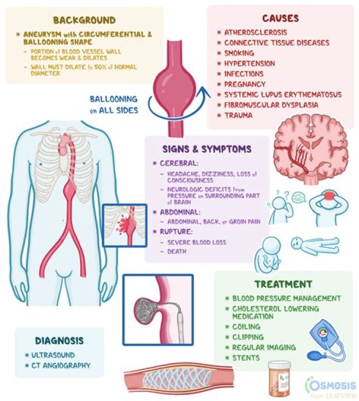 What causes an aneurysm on the pancreas?