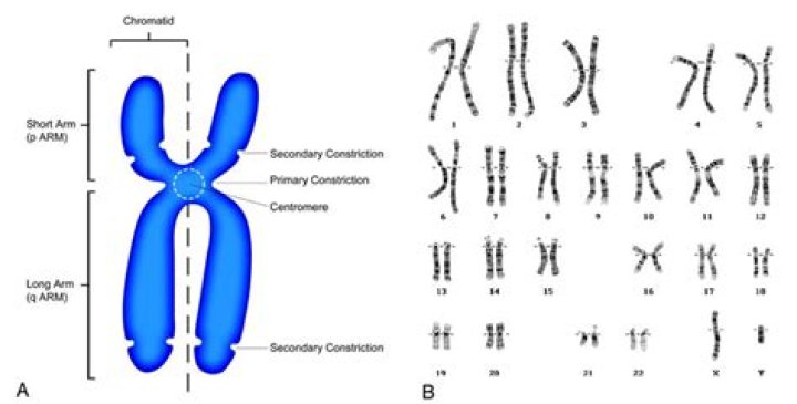 What chromosome number does albinism affect?