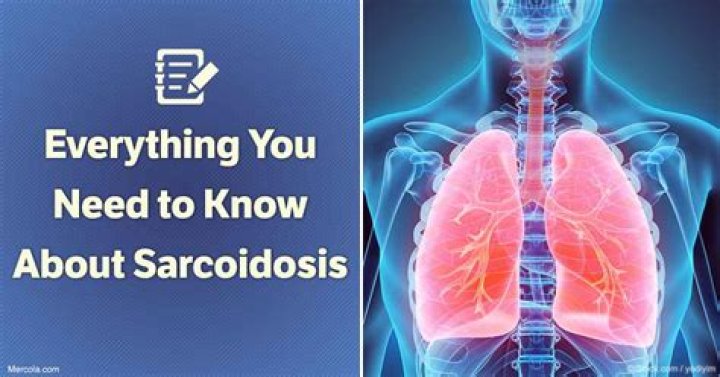 What do you need to know about sarcoidosis?
