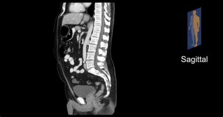What does an MRI of abdomen show?