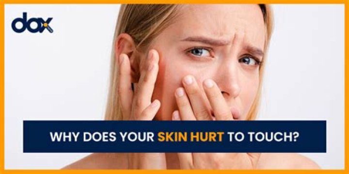 What does it mean when your skin hurts to be touched?