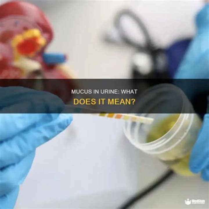 What does mucus in my urine mean?