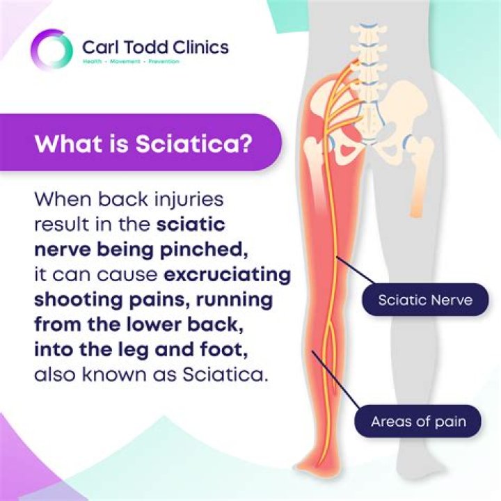 What does sciatica feel like in back?