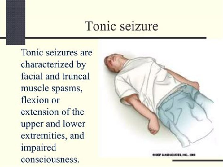 What does tonic mean in seizures?