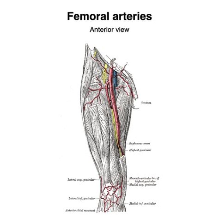 What happens if I cut my femoral artery?
