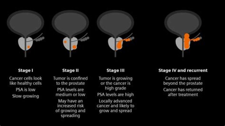 What happens when prostate cancer spreads to lungs?
