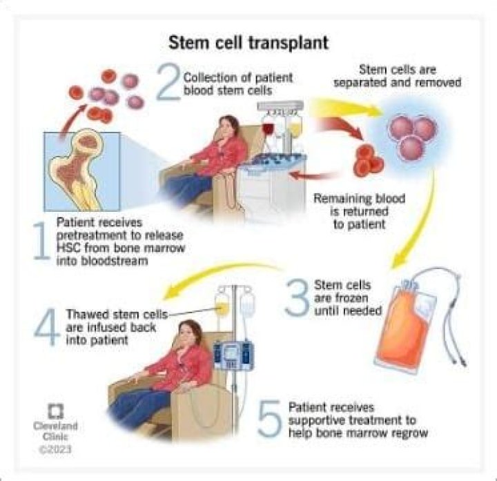 What is BMT infusion?