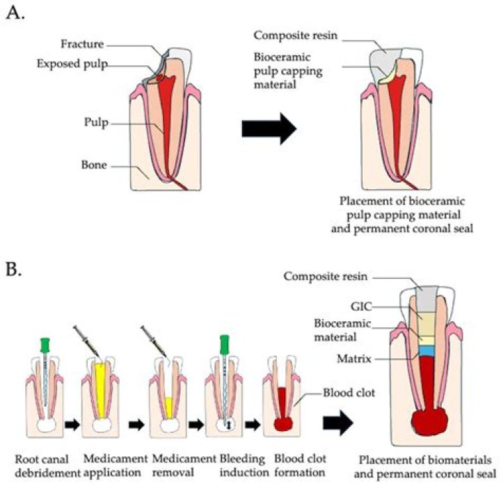 What is considered endodontic treatment?