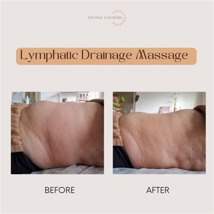 What is lymphatic massage Singapore?