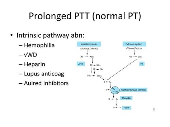 What is normal PTT?