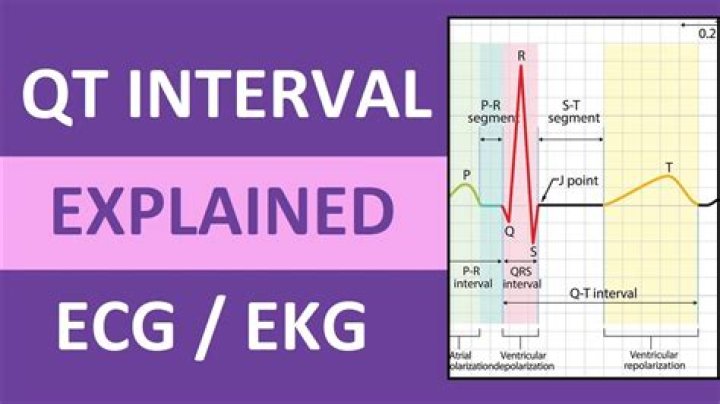 What is normal QT QTc in ECG report?