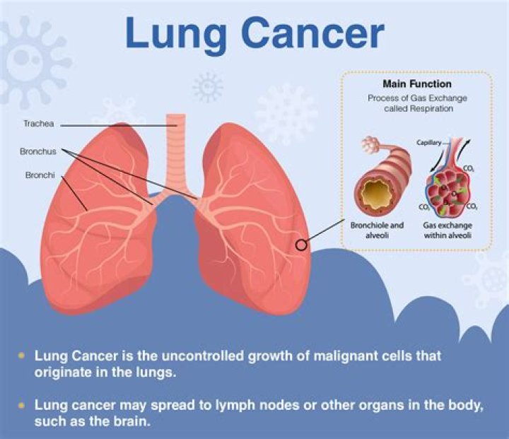What is T1mi in lung cancer?