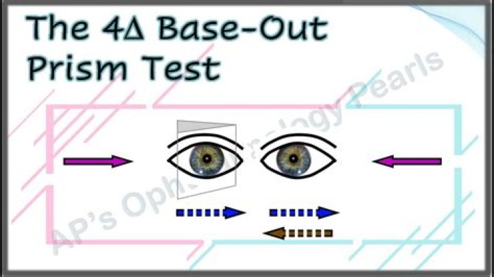 What is the 4 prism diopter base out test?