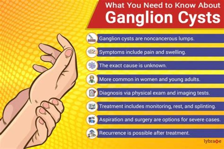What is the cause of a ganglion cyst?