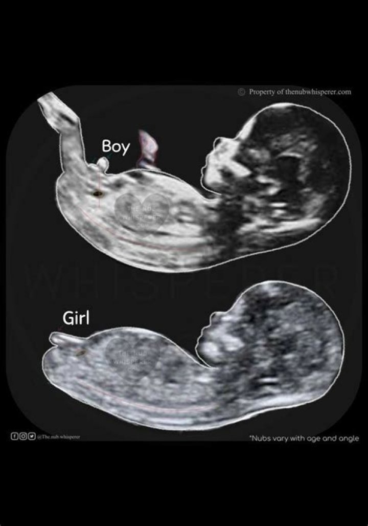 What is the difference between a boy and girl ultrasound?