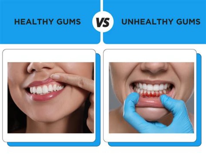 What is the healthiest gum to chew?