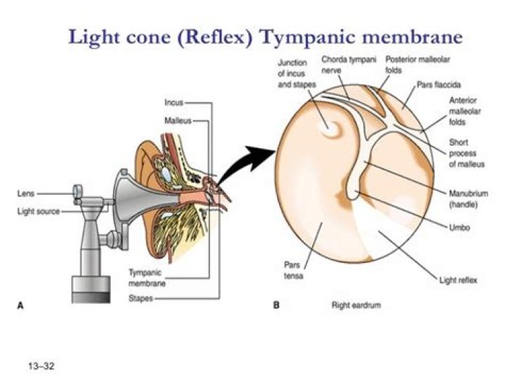 What is the light reflex in the tympanic membrane?