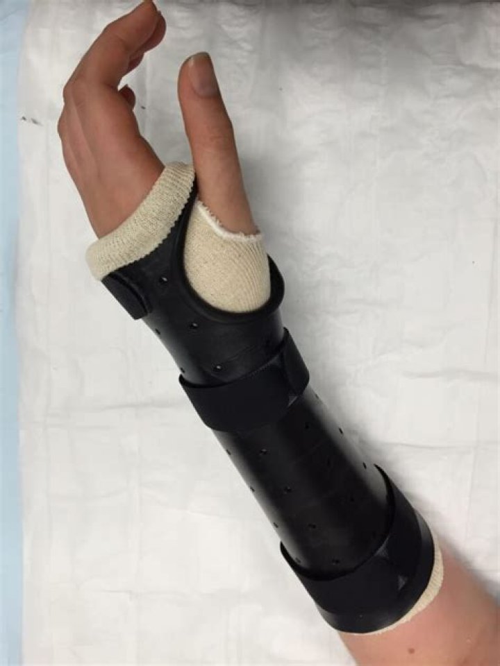 What is the main symptom of forearm splints?