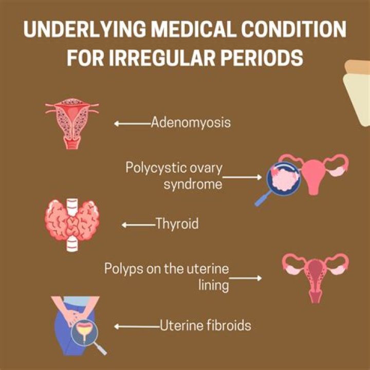 What is the most common cause of cycle irregularities?