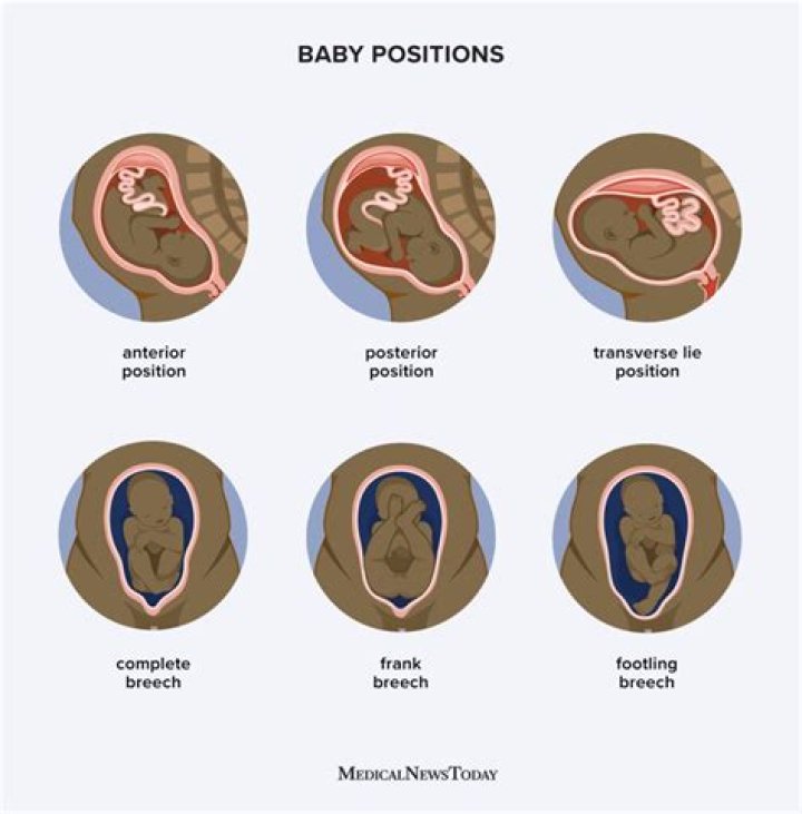 What is the position of baby at 20 weeks?