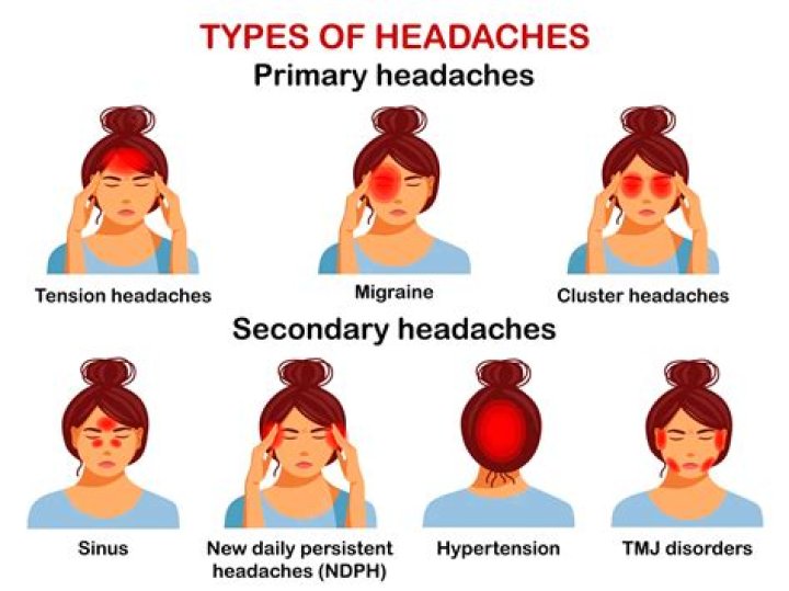 What kind of headache is Covid?