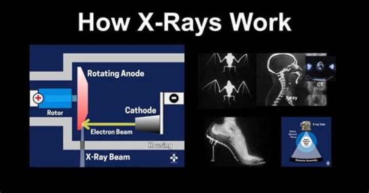 What oil is used in X rays?