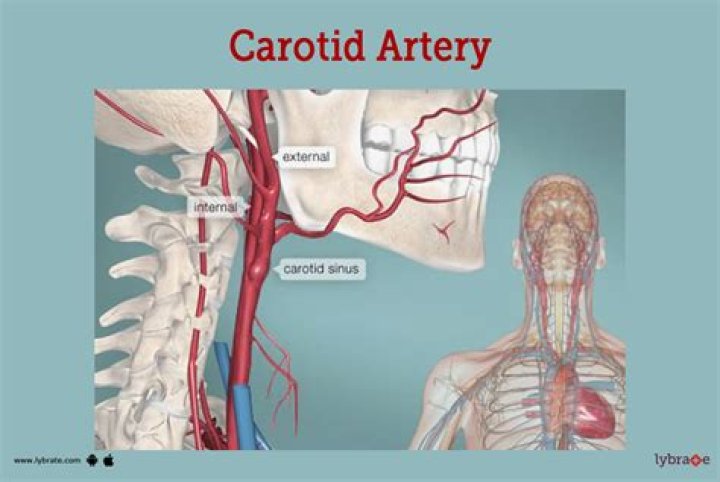 What side of the neck is the carotid artery?