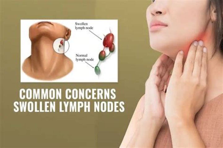 What stage is lung cancer when it is in the lymph nodes?