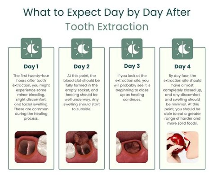 What to expect after having 2 teeth pulled?